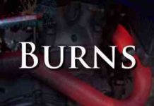 How To Treat Exhaust Pipe Burn: Severity And Treatment – First Aid External First Aid Training - Burns