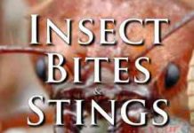 How To Treat Common Bug Bites On The Trail – First Aid External First Aid Training - Insect Bites and Stings