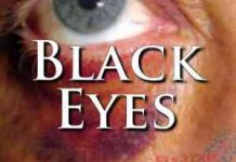 How To Treat A Black Eye With Basic First Aid External First Aid Training - Black Eyes