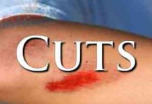 How To Treat A Cut With Basic First Aid External First Aid Training - Cuts