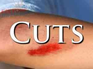 First Aid: External First Aid Training - how to treat a cut