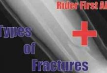 Learn How To Identify Different Types Of Bone Fractures – First Aid Types Of Fractures Header