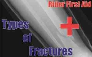 Types Of Bone Fractures Header