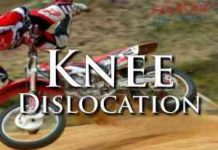 Learn The Symptoms Of A Knee Dislocation And How To Treat It – First Aid First Aid: Trauma - Knee Dislocation